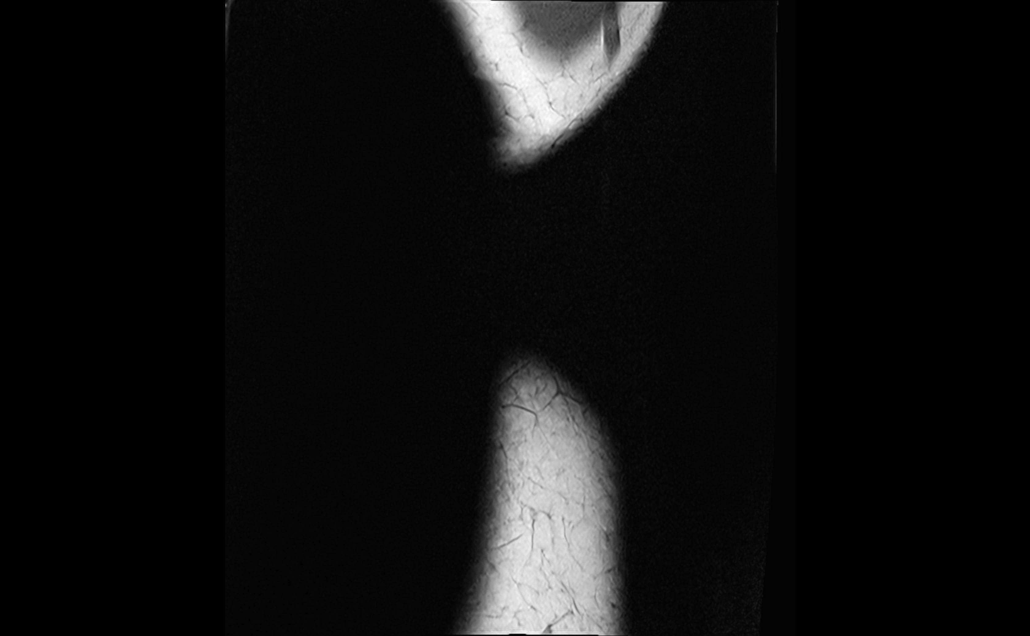 MRI elbow ligaments coronal cross sectional anatomy 3T  radiology  image-img-07001-00001.webp